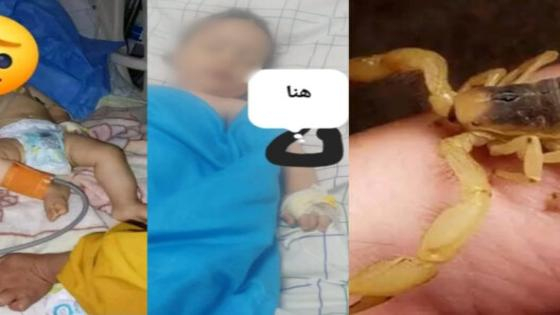 إقليم ورزازات | لذغة عقرب تودي بحياة رضيع في ربيعه الأول