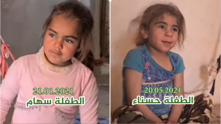 جرسيف | من دوارين متجاورين في حالة مشابهة للطفلة سهام … حسناء طفلة لا تنام ولا تحس بالألم + فيديو