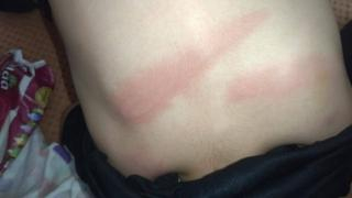 جرسيف | أسرة تلميذ تشتكي تعـ ـنيف إبنها بشكل متكرر من طرف معلمة + صور