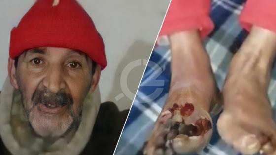 لذوي القلوب الرحيمة | إدريس الأزعر مواطن جرسيفي يناشدكم مساعدته لإجراء عملية جراحية مستعجلة + فيديو