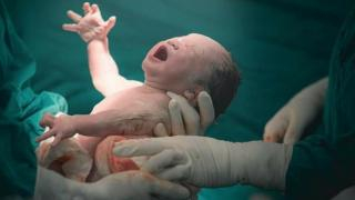 مصر | فريق طبي يخرج جنينا من بطن رضيعة عمرها 7 أيام