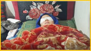 مكناس | شاب يفقأ عيني شابة رفضت الزواج به وينهي حياته شنقا