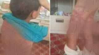 جرسيف | تعرض طفل للكي و التعذيب من طرف زوجة أبيه…هاته هي حقيقة الأمر + فيديو