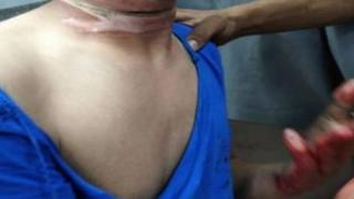 بركان | شاب يذبح عنقه بعد حجز دراجته ثلاثية العجلات أثناء عملية تحرير للملك العمومي