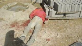 جرسيف | سقوط عامل بناء من علو مرتفع يرسله في حالة حرجة للمستشفى الإقليمي