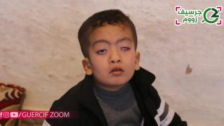 لذوي القلوب الرحيمة.. “ريان” طفل جرسيفي يعاني من مرض نادر على مستوى عينيه (فيديو)