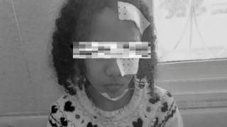 جرسيف | كلاب ضالة تهاجم طفلة متسببة لها في جراح على مستوى الوجه