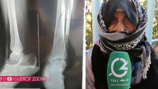 جرسيف | أم تناشدكم مساعدتها لتغطية تكاليف عملية جراحية لإبنتها التي تعرضت لكسور خطيرة + فيديو