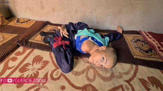 تادرت | عبد الحي..شاب يعاني من الإعاقة منذ ولادته يناشد قائد الجماعة و ذوي القلوب الرحيمة مساعدته + فيديو