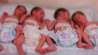 جرسيف | سيدة عشرينية تضع 04 توائم إناث في ولادة طبيعية نادرة بالمستشفى الإقليمي