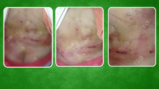 مشاهد صادمة | توقيف سيدة وعشيقها تورطا في تعذيب إبنها ذو 5 سنوات بحي اولاد حموسة بجرسيف + صور