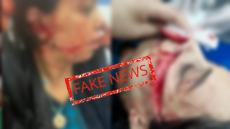 جرسيف | هذه هي حقيقة تعرض سيدة للكريساج بواسطة السلاح الأبيض قرب دوش الكرمة