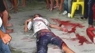 جرسيف | شاب يتعرض لاعتداء خطير بالأسلحة البيضاء والدرك يفتح تحقيقاً